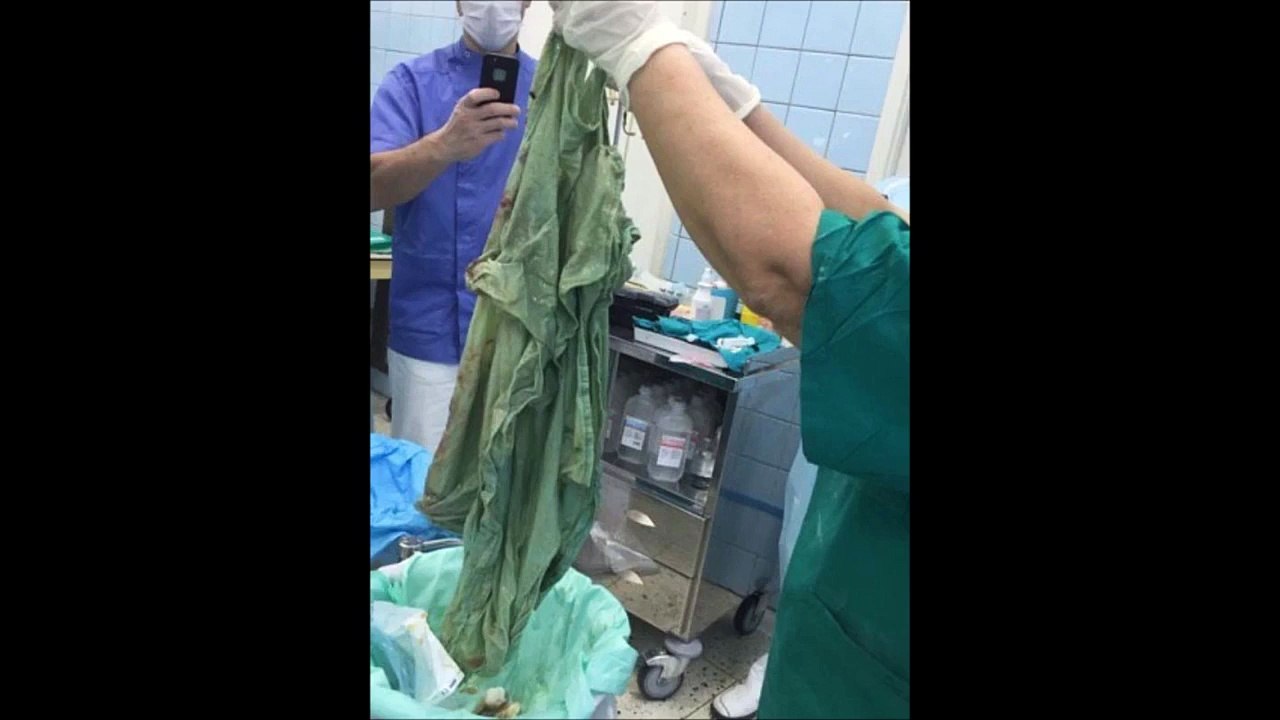 【驚愕】出産後に、お腹が、大きく膨んだ！メスを入れたらありえないものが！