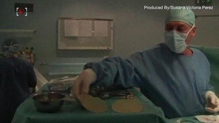 FDA: Rare Cancer Linked to Breast Implants