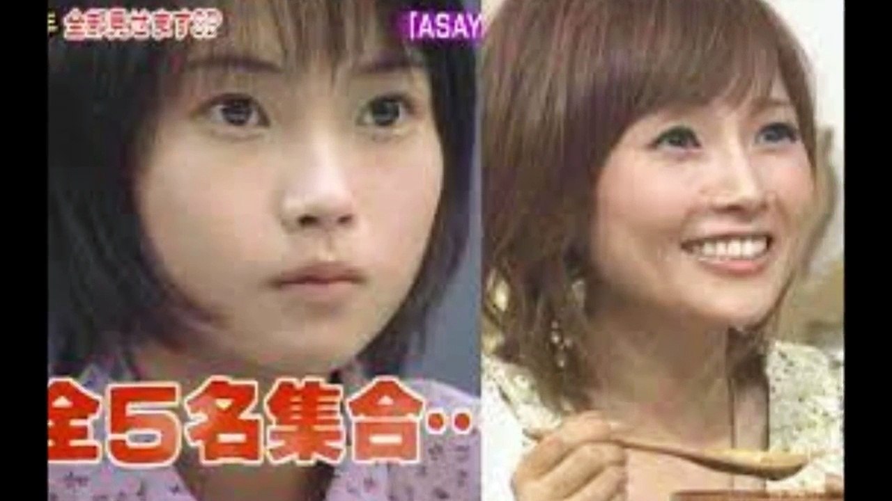 【整形画像】芸能人・有名人のビフォー・アフターまとめ【目頭切開】
