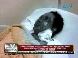 24oras: OFW sa Dubai, nadiskubreng may kakaibang sakit