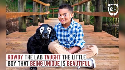 Atteint d'un problème de peau, ce garçon avait perdu le goût de la vie, jusqu'à ce qu'il fasse une rencontre inattendue