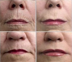 PELE PERFEITA com produto barato MASCARA CASEIRA 10 anos mais JOVEM em 10 dias