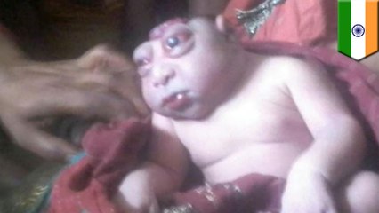 Woman in India gives birth to deformed ‘alien’ baby