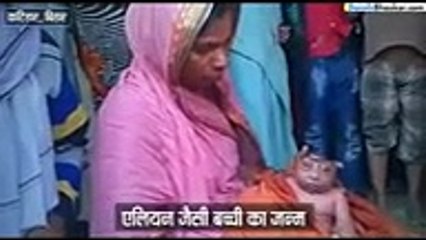 Strange Face Kid Born In Muslim Family Shocked Everyone