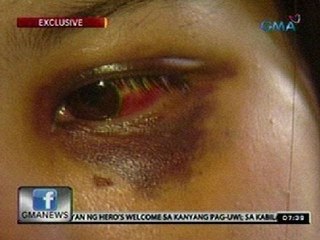 24 Oras: Exclusive: Call center agent,   binugbog at muntik nang magahasa