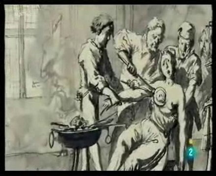 Cancer de mama: Historia de la deteccion precoz