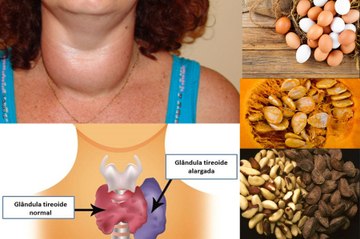 Como regular a TIREOIDE naturalmente alimentos que regula e desregula por Nina Della Rosa