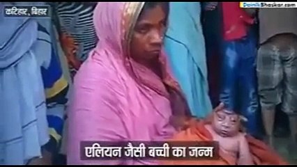 Strange Face Kid Born In Muslim Family Shocked Everyone