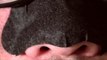 Blackhead Removal On Nose Strips | Blackhead Remover Peel Off Mask 2017