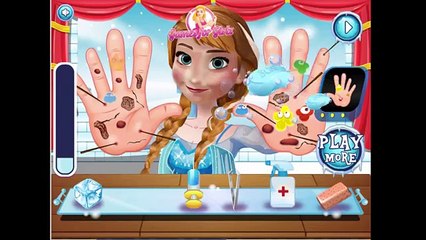 Дисней замороженные игра Принцесса Анна рука доктор хирургия видео Игры для Дети