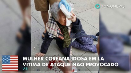 Mulher coreana idosa em Los Angeles é vítima de ataque não provocado.
