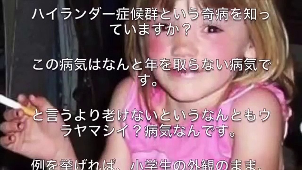 【難病】年をとらないハイランダー症候群という難病の真実と実態とは…！？