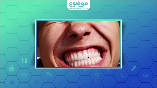 #موضوع: الضغط على الأسنان اثناء النوم