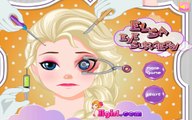 Elsa Eye Surgery Frozen Queen Elsa Doctor Game