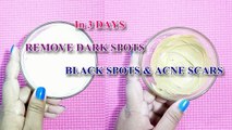In 3 DAYS- REMOVE DARK SPOTS, BLACK SPOTS & ACNE SCARS | 100% Natural Treatment For Dark Spots http://BestDramaTv.Net