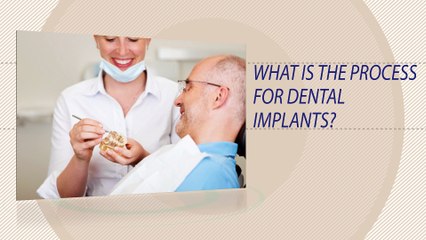 Dental Implants - FAQ - Spring Branch, TX