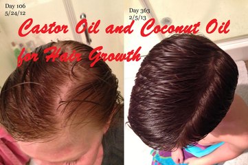 Castor Oil and Coconut Oil for Hair Growth || Home Remedies