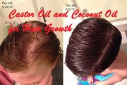 Castor Oil and Coconut Oil for Hair Growth || Home Remedies