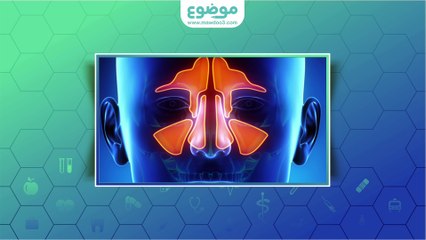 #موضوع: أسباب التهاب الجيوب الأنفية
