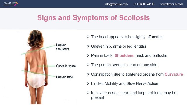 Scoliosis of the Spine: Causes, Types & Treatments