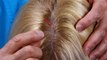 Hair Stranding-Revolutionary Hair Loss Treatment With Amazing Results,Free Trial-InvisaBlend,New Jersey