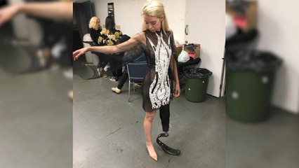 Boston Bombing Survivor Walked The Runway At Vancouver Fashion Week