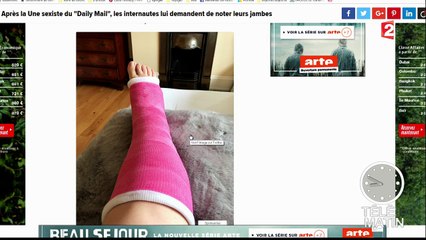 Des jambes contre le sexisme