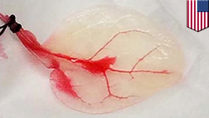 Researchers turn spinach leaves into beating heart tissue