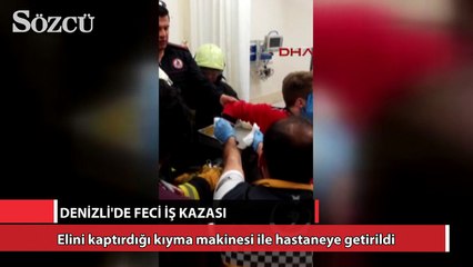 Elini kaptırdığı kıyma makinesi ile hastaneye getirildi