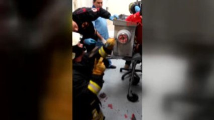 Denizli Elini Kaptırdığı Kıyma Makinesi Ile Hastaneye Getirildi