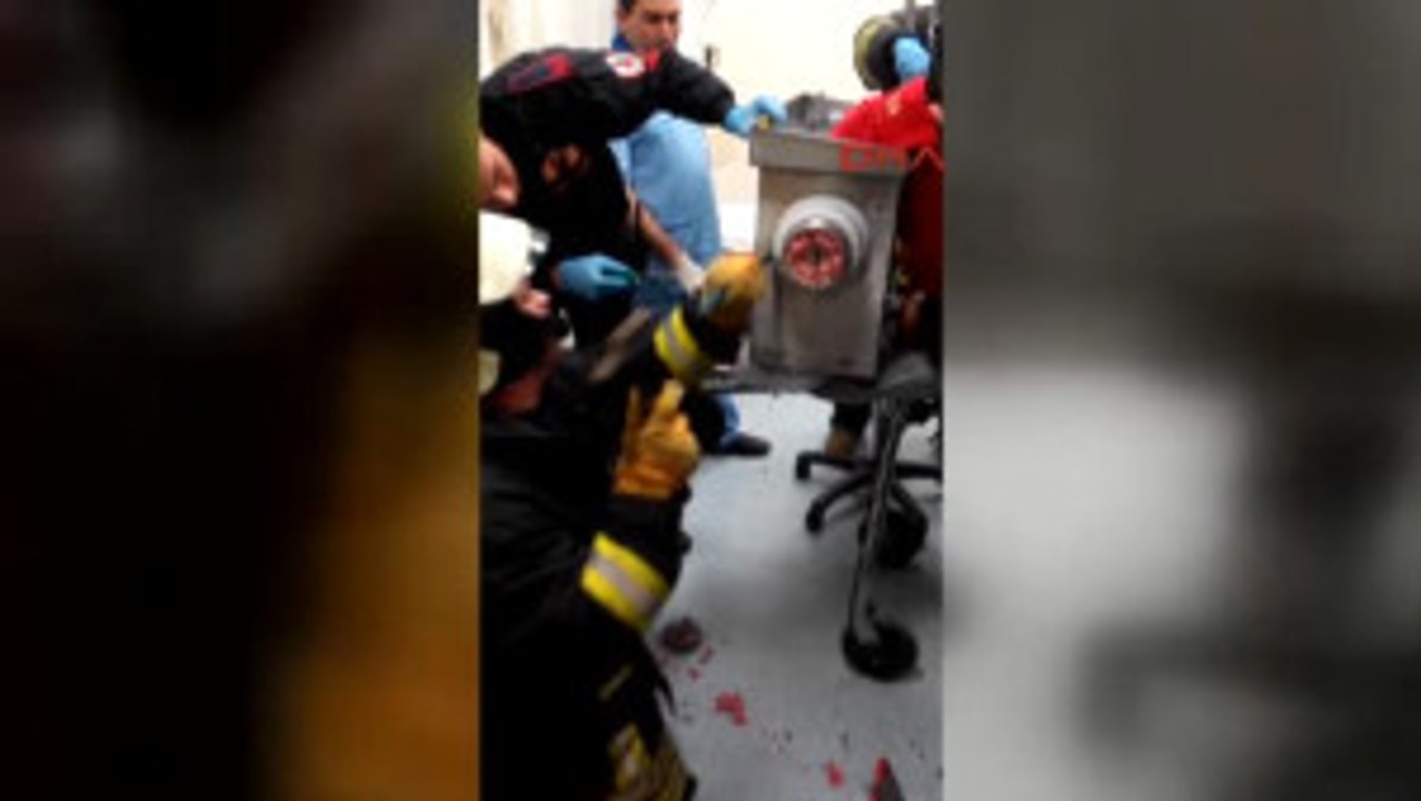 Denizli Elini Kaptırdığı Kıyma Makinesi Ile Hastaneye Getirildi