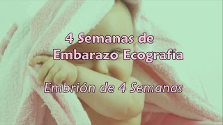 4 Semanas de Embarazo - Ecografía 4 Semanas de Gestación-J5gAwVH-x7U