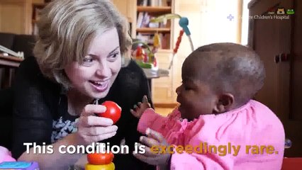 Une Ivoirienne est née avec 4 jambes et 2 colonnes vertébrales