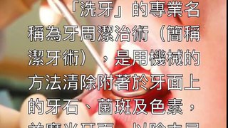 看完这个洗牙过程，才明白牙齿健康实在太重要了