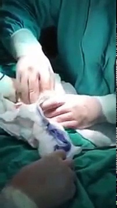 il se coinçe une plante Yucca 45 cm dans l'Anus +18 ans .zone infos