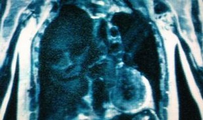 Abyzou List Horror Villains Antiheroes