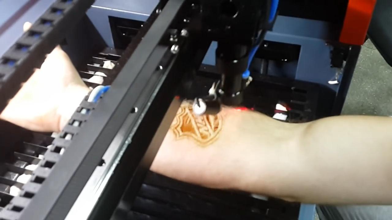 Laser Tattoo