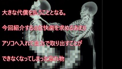 【閲覧注意】レントゲン写真で見る世界がおもしろすぎて凄すぎると話題にｗｗ【衝撃】【画像集まとめ】