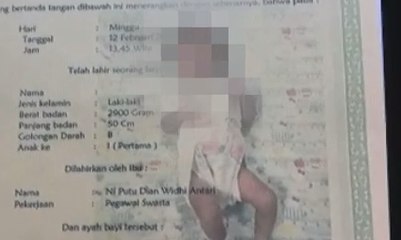 Diduga Depresi, Seorang Ibu Tega Lukai Bayinya