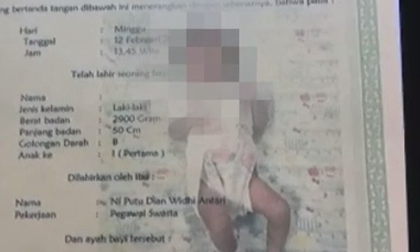 Diduga Depresi, Seorang Ibu Tega Lukai Bayinya