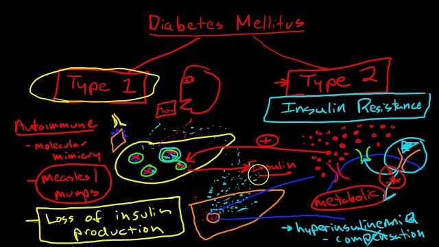 Pathophysiology of Diabetes Mellitus