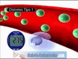 Que es la diabetes mellitus - Diferencias entre la diabetes tipo 1 y diabetes tipo 2