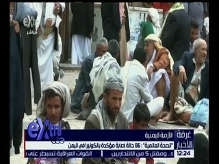 غرفة الأخبار | الصحة العالمية: 86 حالة إصابة بمرض الكوليرا في اليمن