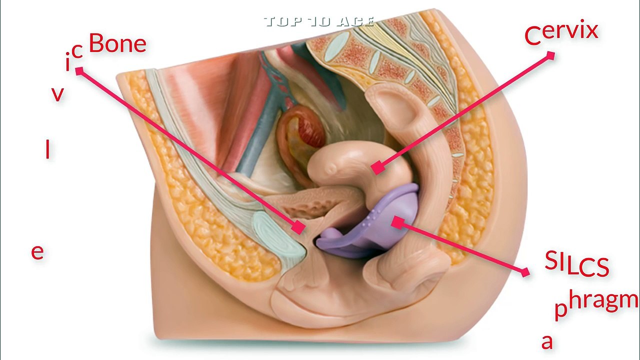 Sex With Silcs Diaphragm - [To Control Unwanted Pregnancy] सिल्क्स डायाफ्राम के साथ सेक्स