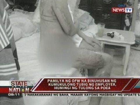 Pamilya ng OFW na binuhusan ng kumukulong tubig ng employer, humingi ng tulong sa POEA