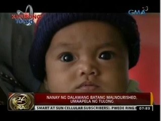 Kapusong Totoo: Nanay ng dalawang batang malnourished, umaapela ng tulong