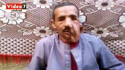 بالفيديو.. صاحب الوجه المترهل بالمنيا: احتاج عملية تجميل بـ 20 ألف جنيه