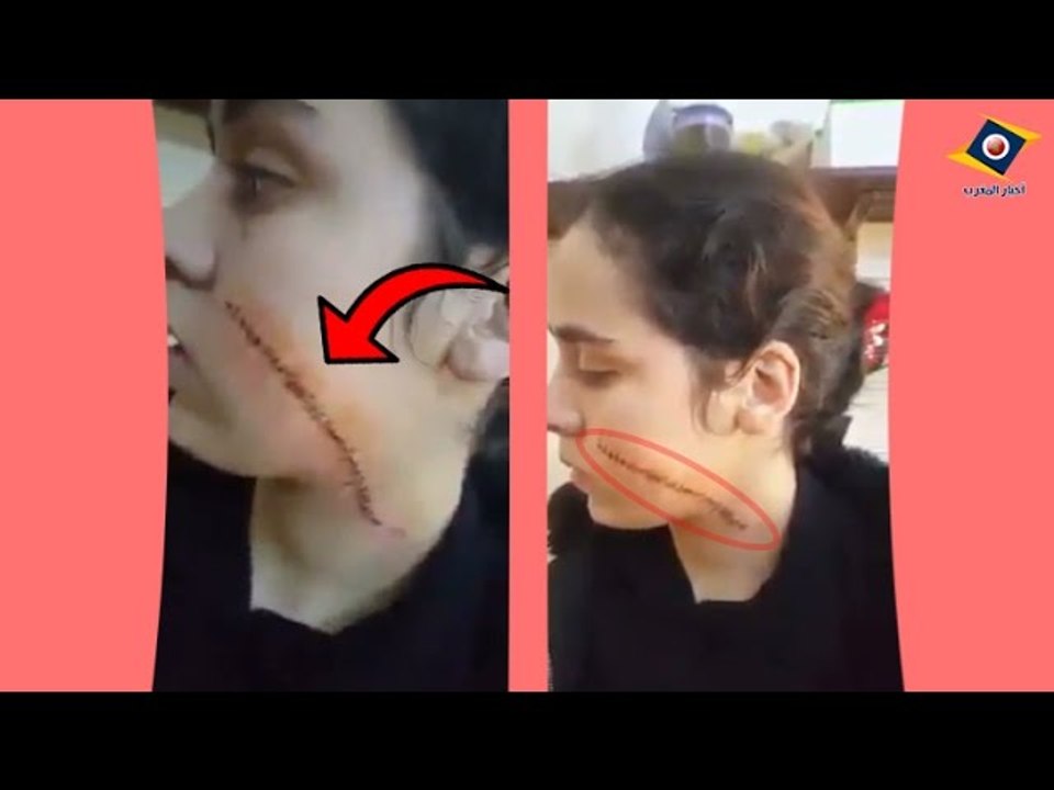 شوفو أب شوه لبنتو وجهها حيت مبغاتش تعطيه فلوس حشومة عليه و الله