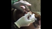0811 1721 280, Agar wajah Putih di Jakarta Selatan Rinanda  Skin Care Center