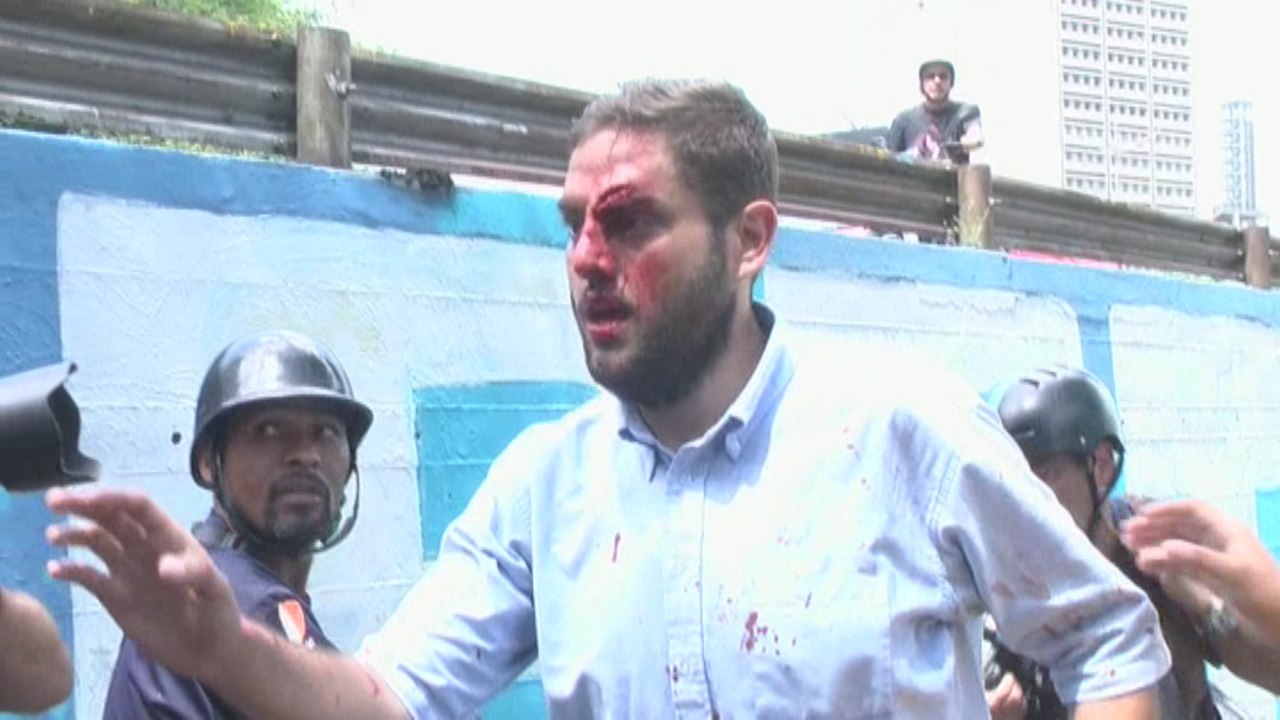Diputado opositor es agredido en protesta ante Defensoría venezolana